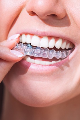 Close up of a person placing a clear aligner on their upper teeth