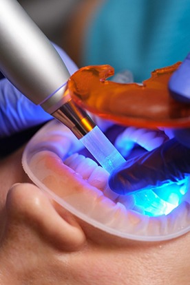 Close up of person receiving dental bonding