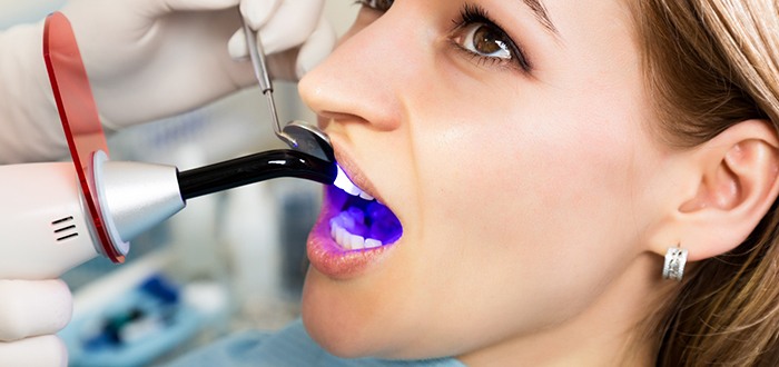 a person getting a tooth-colored filling