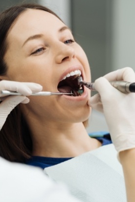 Woman in dental chair opening her mouth for treatment