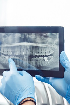 a dentist showing their patient X rays of their teeth